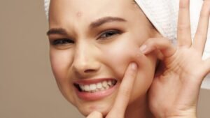 womensway 127 Egy fiatal nő, aki pattanást mutat az arcán, miközben mosolyog.