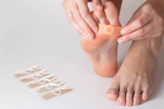 Egy női láb, amelyen egy tapasz van, a talpon, a háttérben tapaszcsomagokkal.