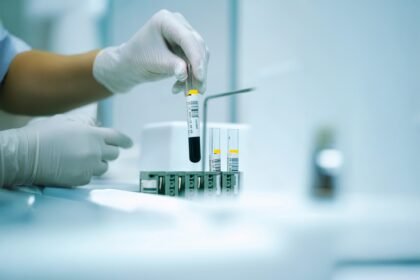 Laboratóriumi vérvizsgálat folyamata egészségügyi szakember által