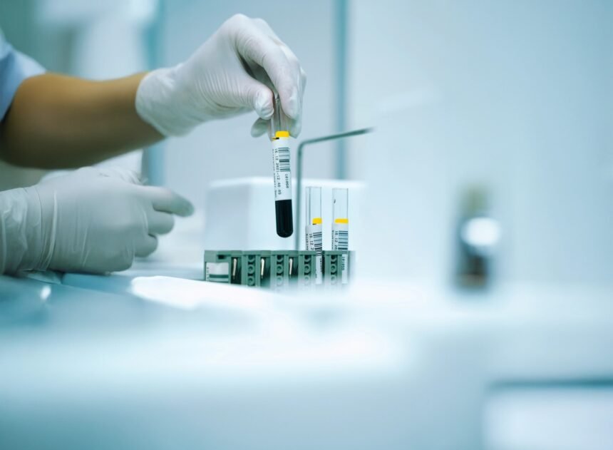 Laboratóriumi vérvizsgálat folyamata egészségügyi szakember által