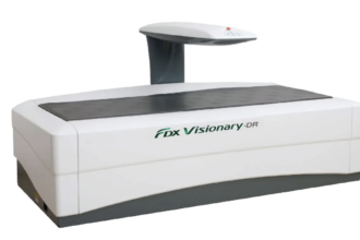 A csontsűrűség vizsgálat előtt sok páciensben felmerül a kérdés, hogy mire számíthat a folyamat során, és milyen költségekkel jár a vizsgálat. A megfelelő tájékozódás segít abban, hogy a páciens magabiztosan és felkészülten érkezzen.